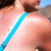 Two Types of Skin Cancer Are Skyrocketing—Are You At Risk?