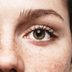 10 Sneaky Places You Can Get Skin Cancer (That Aren’t on Your Skin)