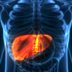 9 Silent Signs of Liver Cancer You Shouldn’t Ignore